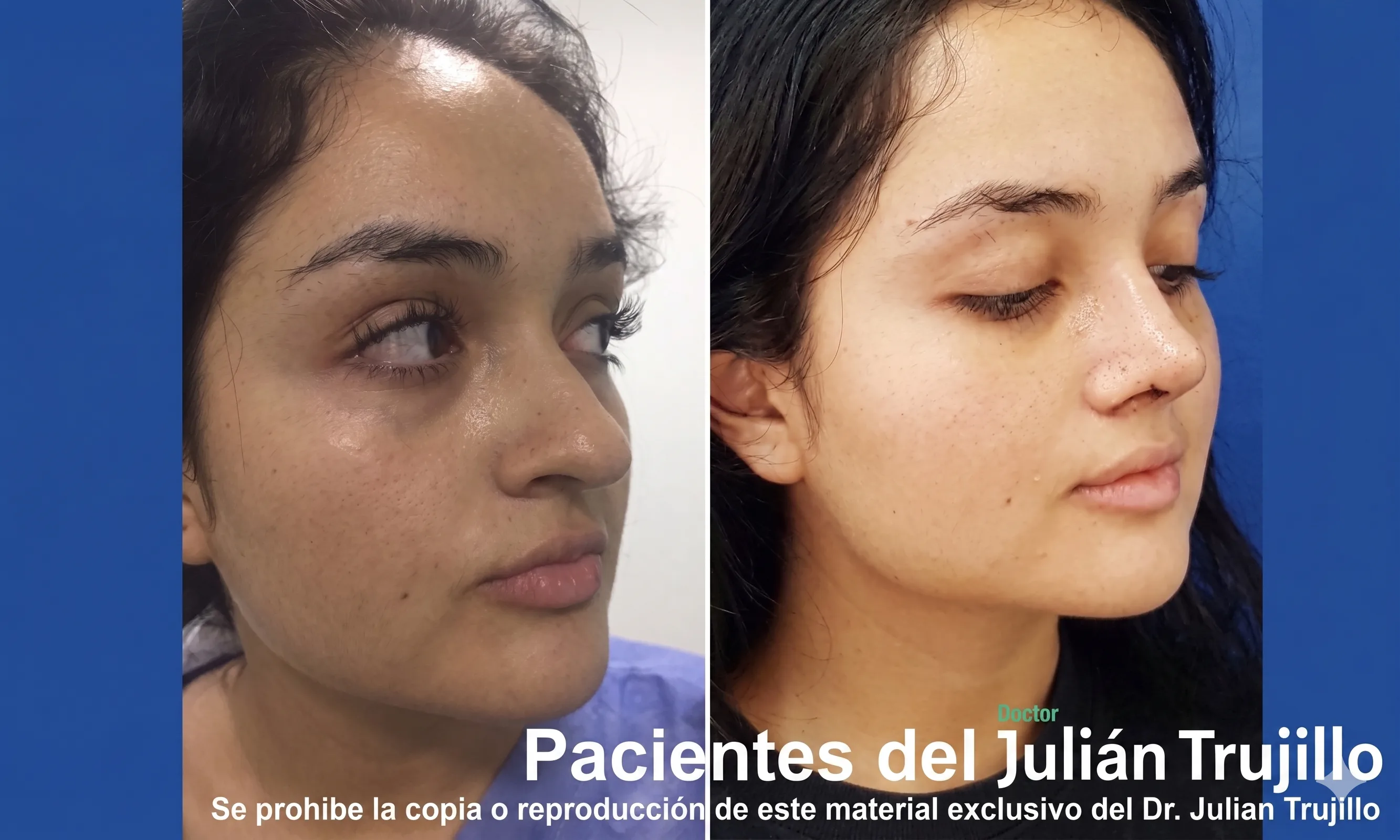 Before & After 1